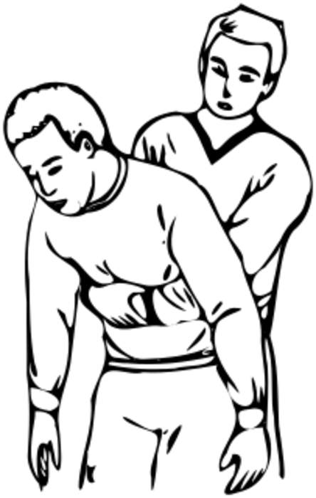 Abdominal thrusts: First aid procedure