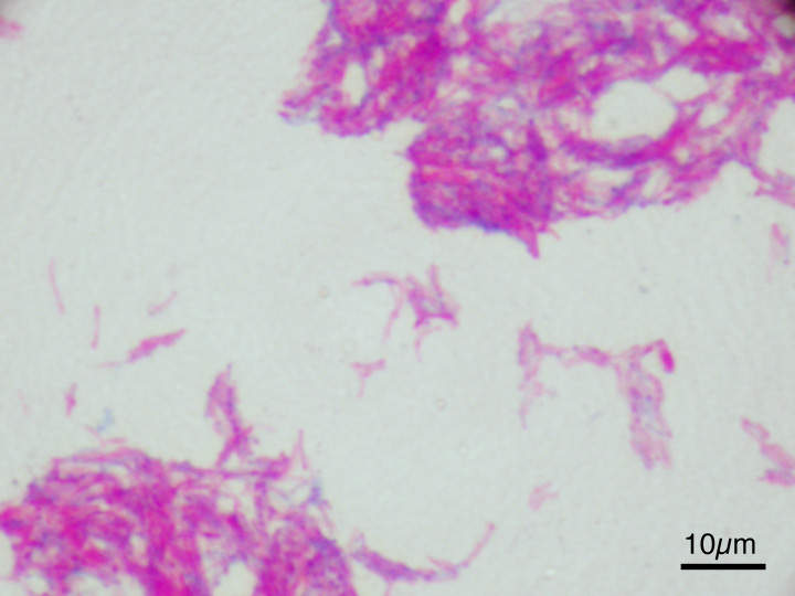 BCG vaccine: Vaccine primarily used against tuberculosis