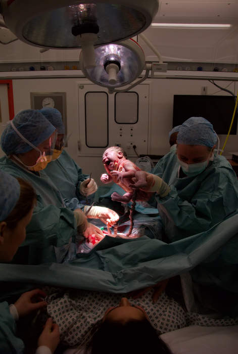 Caesarean section: Surgical procedure in which a baby is delivered through an incision in the mother's abdomen