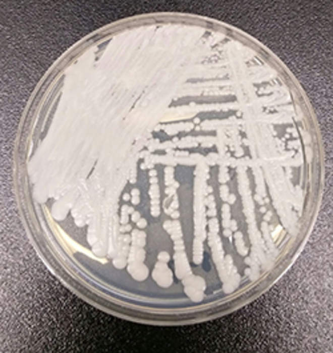 Candida auris: Species of fungus