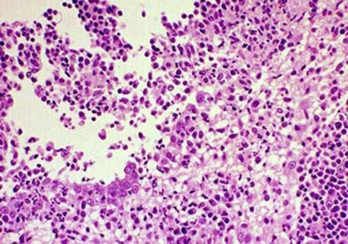 Feline infectious peritonitis: Highly deadly disease that affects cats