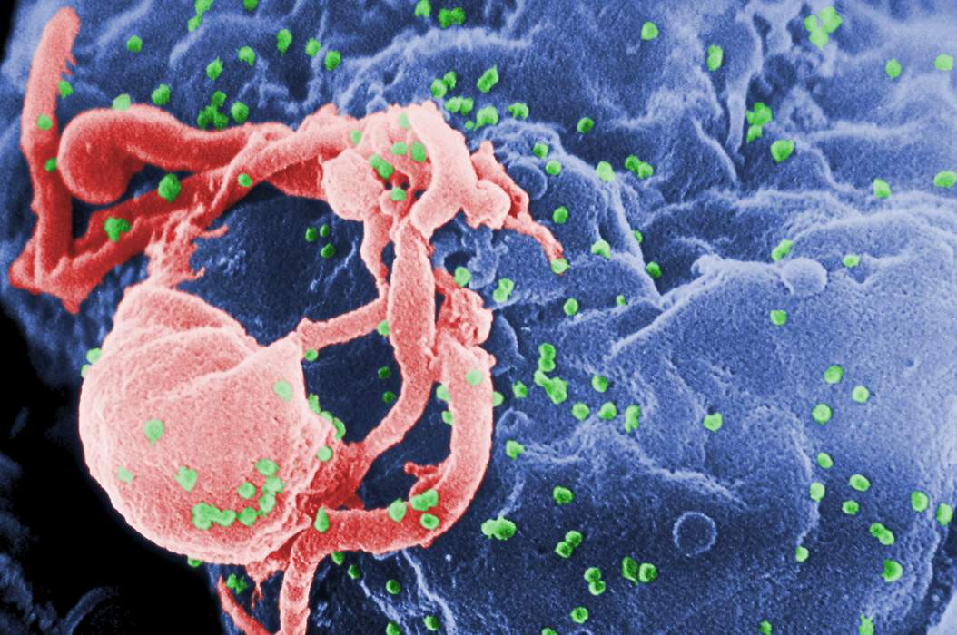HIV: Human retrovirus, cause of AIDS