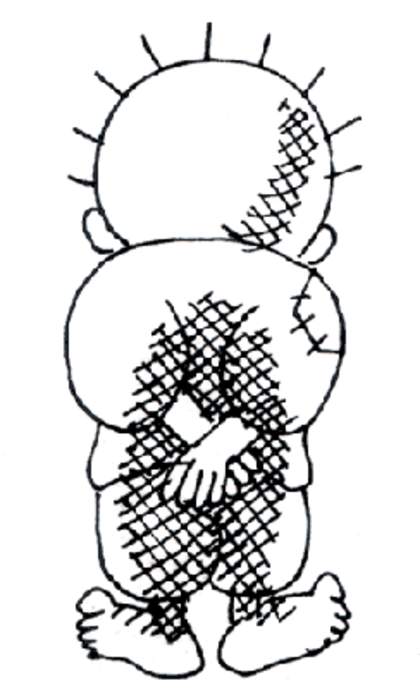 Handala: Symbol and personification of the Palestinian people