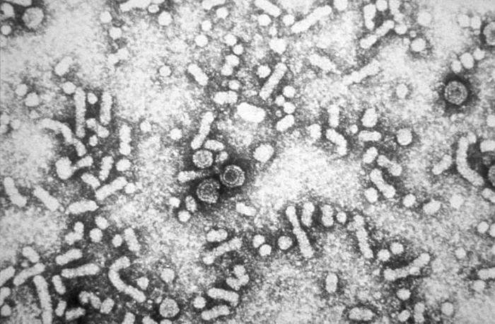 Hepatitis B: Human viral infection