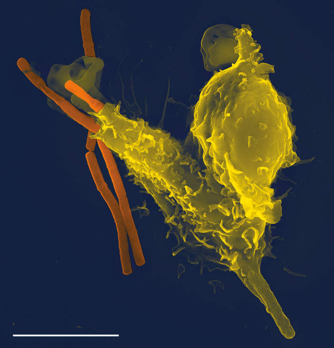 Immune system: Biological system protecting an organism against disease