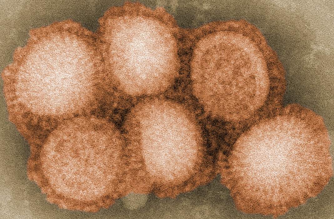 Influenza A virus subtype H3N2: Virus subtype