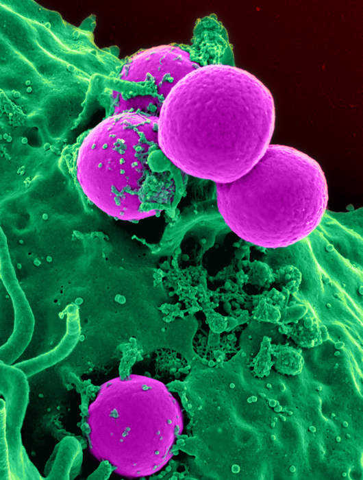 Methicillin-resistant Staphylococcus aureus: Bacterium responsible for difficult-to-treat infections in humans