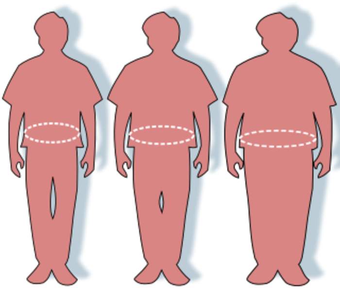Obesity: Medical condition in which excess body fat harms health