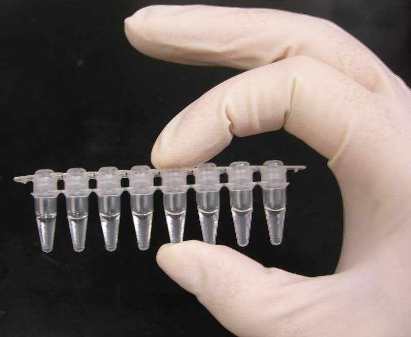 Polymerase chain reaction: Laboratory technique to multiply a DNA sample for study