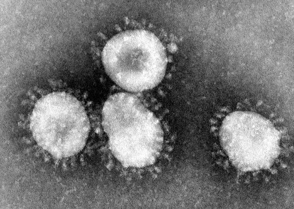 SARS: Disease caused by severe acute respiratory syndrome coronavirus