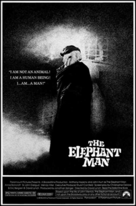 The Elephant Man (film): 1980 film by David Lynch
