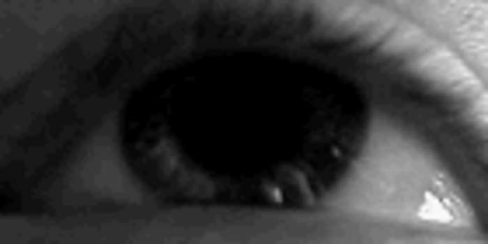 Vertigo: Type of dizziness where a person has the sensation of moving or surrounding objects moving
