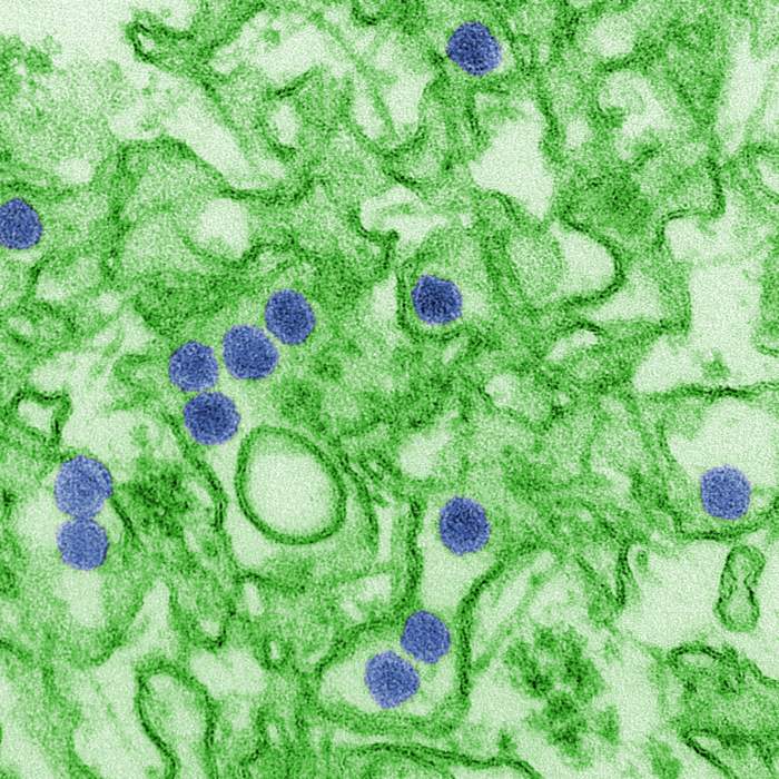 Zika virus: Species of flavivirus